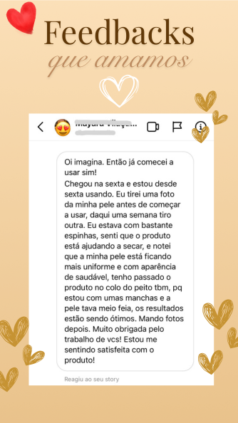 FEEDBACKS (334 x 594 px)-6